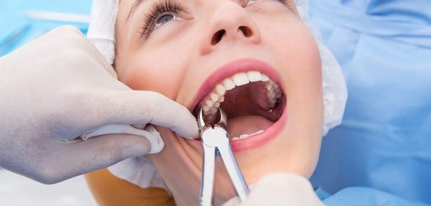 Tooth Extraction for Comfortable Oral Surgery&nbsp;Care