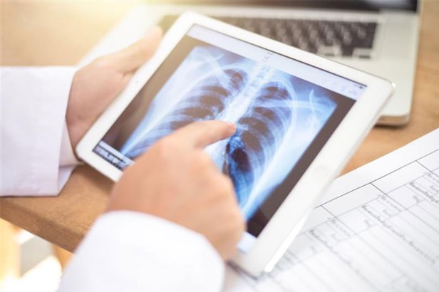 Lung Cancer Screening and Early Detection Glendale: What You Should&nbsp;Know
